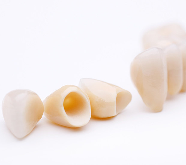 Orange Dental Crowns and Dental Bridges