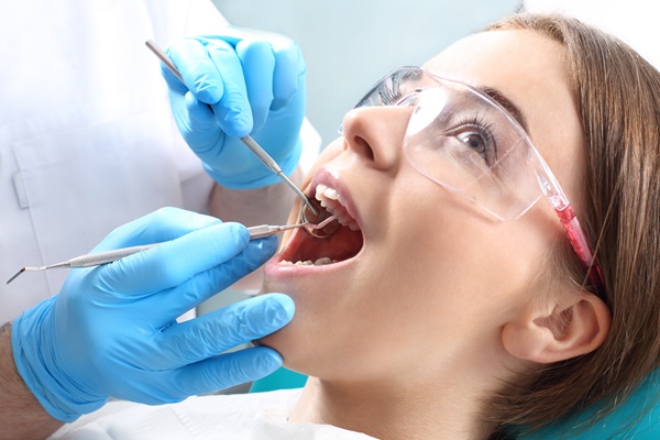 Are Composite Dental Fillings Permanent?