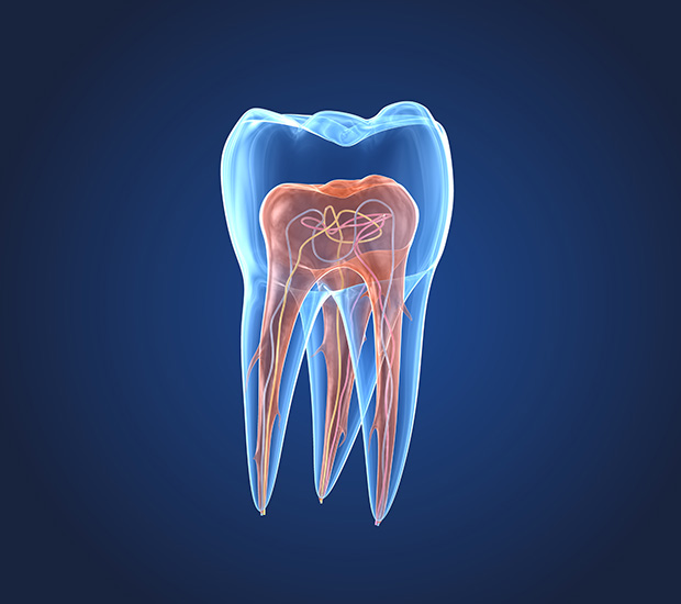 Orange What is an Endodontist